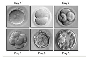 Southern California Fertility Center | The Impact of Age on IVF Success Rates: What You Need to Know